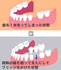 �����̎�������Ďx���ɂ��ău���b�W�����������