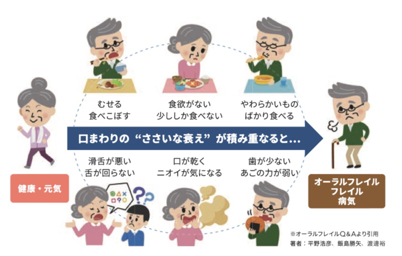 �I�[�����t���C���̐i�s