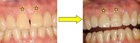 ���~�l�[�x�j�A