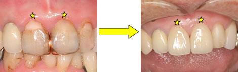 �Z���~�b�N�N���E���A�C�����[