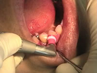 �N���[�j���O�i�o�l�s�b�j