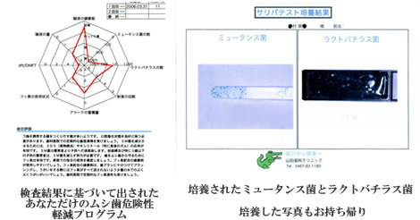 �T���o�e�X�g�|�{����