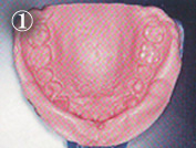 �z���C�g�j���O���ʔ�r�}